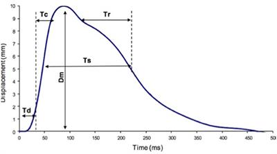 Evaluation of Calf Muscular Function During the Recovery Phase After the Repair of an Achilles Tendon Rupture